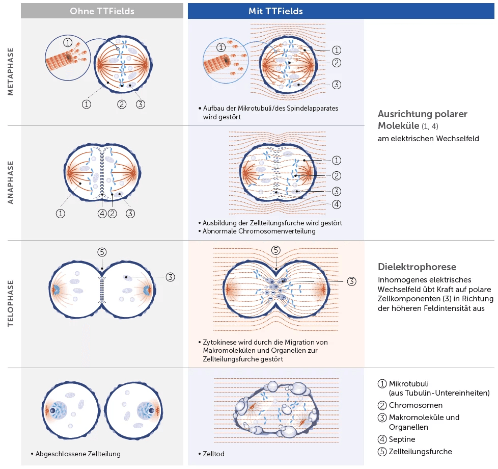 Illustration of tumor treating fields mechanism of action on cancer cells